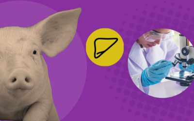 Saving lives with pig livers: FDA approves new trial with a spin on an old treatment