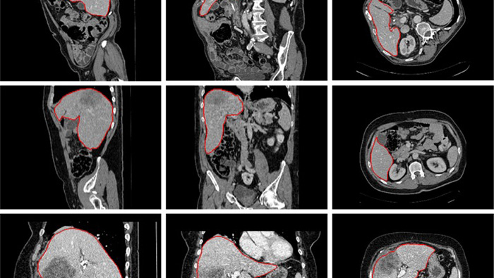 Creating the first national donor image sharing hub