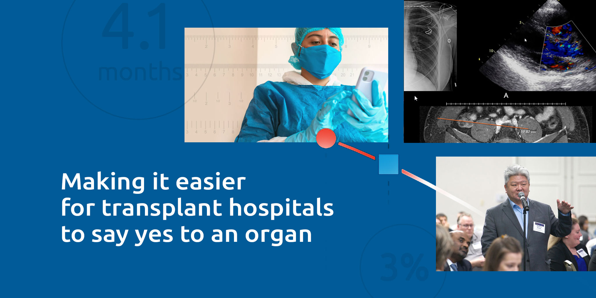 Organ acceptance UNOS