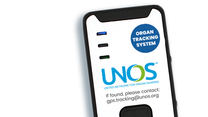 UNOS organ tracking application.